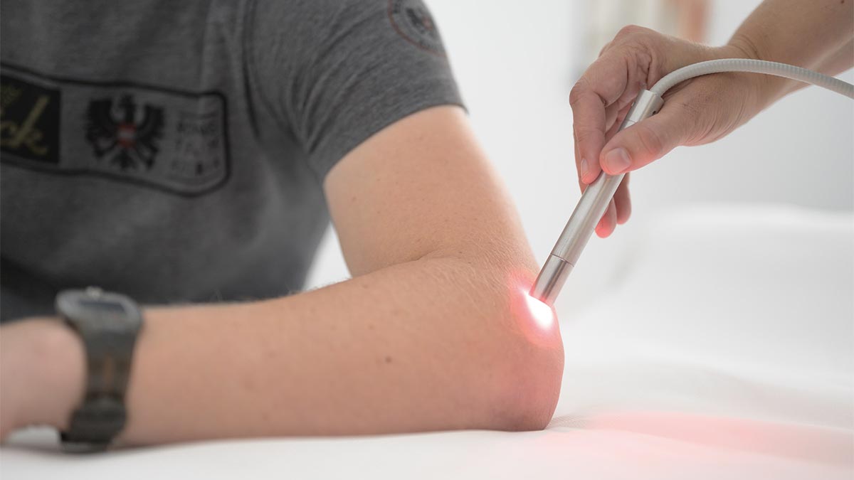Laserpuntura